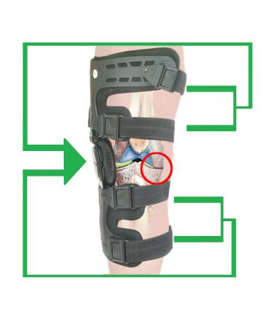 Orthomen Lateral Unloader Knee Brace for Osteoarthritis | Best Offloader for Bone on Bone Joint Degeneration - L1851 L1843 (Left) - Worldwide Shipping - Buy Online on GoSupps.com