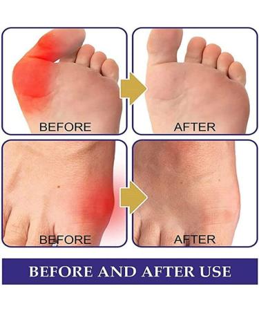 Buy 48 Herbalbase Japanese Bale Toe Patches | Pain Relief for Inflamed Balls | Anti-Bale Toe Patch | Fast International Shipping - Buy Online on GoSupps.com