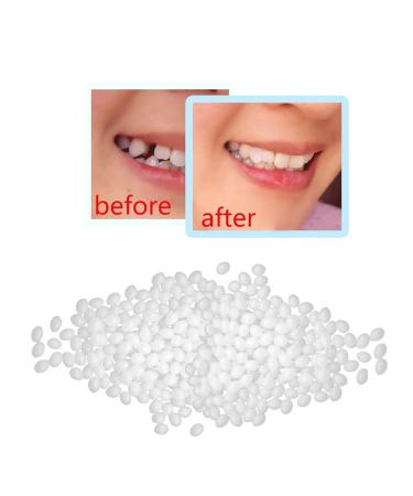 100g Tooth Glue for Make-up Dentures - Temporary Filling for Broken Teeth & Bite - One Size White | International Shipping Available - Buy Online on GoSupps.com