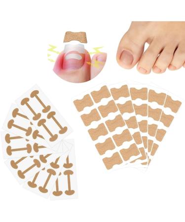124 PCS Ingrown Toenail Kit 2 Styles Breathable Self-Adhesive Elastic Toenail Correction Patch for Toenail Treatment Fingernail Care Protect Toe Nail Nail groove correction gray nail toe care - Buy Online on GoSupps.com