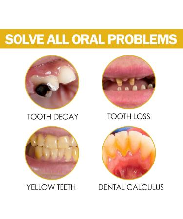 7-Piece Gums Care Mouthwash Set | Natural Gum Refresher Gel & 360 Dental Care Drop - No Bleaching Agents - Shop Internationally - Buy Online on GoSupps.com