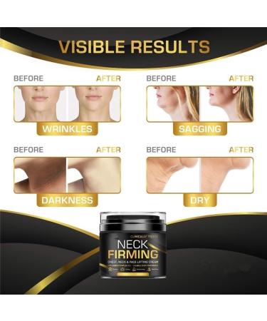 Gold Collagen Anti-Aging Cream Neck Firming Cream Neck Mask Firming Cream Desalination Neck Care Anti-Aging Cream For (Color : 3Count (Pack of 3)) - Buy Online on GoSupps.com