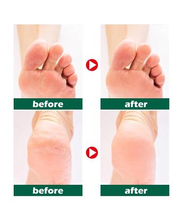 Anti-Dry Cracks & Dead Skin Removal for Hands & Feet | Men's Hygiene Care - Green (1 Pack) - Buy Online on GoSupps.com