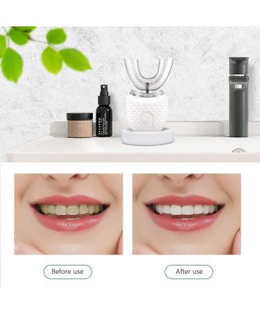 ZWPARTS Ultrasonic Toothbrush Electric Toothbrush 360 Automatic Ultrasonic Toothbrush Cold Teeth Whitening Instrument Toothbrush IPX7 Waterproof (White) - Buy Online on GoSupps.com