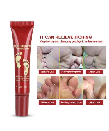 Crema para el Tratamiento de los Pies 15g | Hidratante Natural para Aliviar Hongos y Picaz n | Cuidado Efectivo para Plantas - Buy Online on GoSupps.com