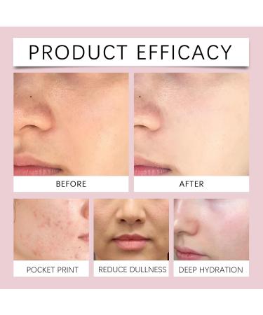 Niacinamide Toner Spray With Rose & Aloe Extract - Locks Moisture Relieves Dryness Brightens Skin Keeps Hydrated Smooth All Day(3PCS) - Buy Online on GoSupps.com