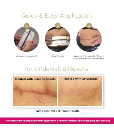 Embrace Active Scar Defense - FDA-Cleared Silicone Scar Sheets for New Scars | 60 Day Supply | Medium 2.4 Inch - Buy Online on GoSupps.com