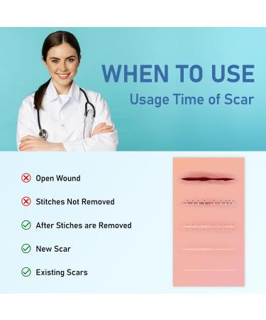 Medical Grade Silicone Scar Sheets - Reusable Silicone Gel Tape for Surgical Scars C-Section Burns & Acne - 1.6 x 150 Roll (3.8M - Buy Online on GoSupps.com