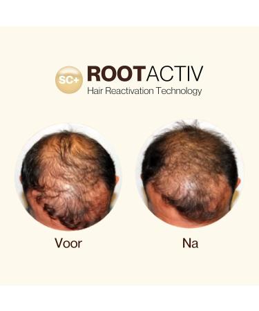 TEITV Stem cell hair growth serum for women and men Natural Hair Growth Treatment Reduces hair loss 75 ml - Buy Online on GoSupps.com