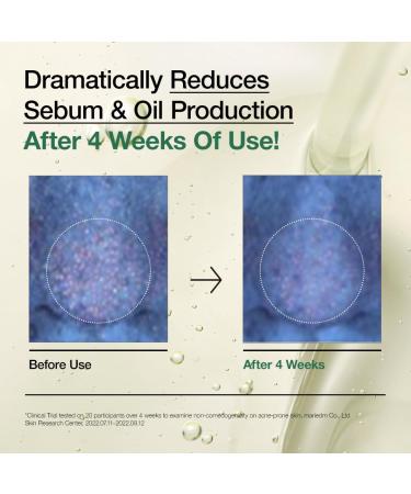 Anua Double Cleanser Duo for Facial Cleansing : Heartleaf Pore Control Cleansing Oil & Heartleaf Quercetinol Pore Deep Cleansing Foam for Double Cleansing Korean Skincare - Buy Online on GoSupps.com