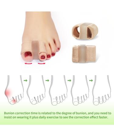 Gel Bunion Toe Separators | Silicone Spacers for Overlapping Toes | Breathable Foot Pain Relief for Men & Women - Buy Online on GoSupps.com