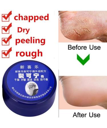 Lintat Hand & Foot Crack Cream | Natural Moisturizer for Dry Skin Heels & Chapped Skin | Anti-Dry Ointment for Int'l Shipping - Buy Online on GoSupps.com