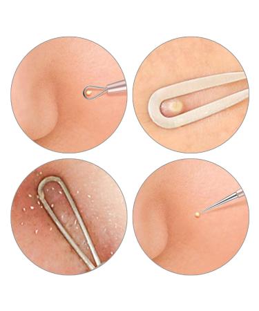 Blackhead Remover Acne Treatment Kit - Professional Skin Care Tools for Pimple Popper, Blemish, and Whitehead Extraction - 5 Piece Stainless Steel Set with Travel Case (Silver) - Buy Online on GoSupps.com