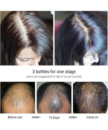 Okeny's Hair Growth Essence Anti-perte De Cheveux Favorisant La Croissance Des Cheveux Vaporisateur pais D'essence - Buy Online on GoSupps.com