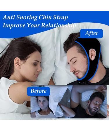 2023 Anti-Snoring Chin Straps - Ultimate Snoring Solution & Relief | Blue Snoring Stopper - Buy Online on GoSupps.com