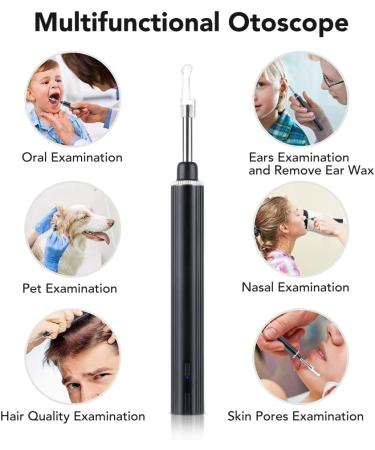 Renyqatt 3.9mm Smart Wireless WiFi Ear Picker | HD Visual Tool | USB Charging - Buy Online on GoSupps.com
