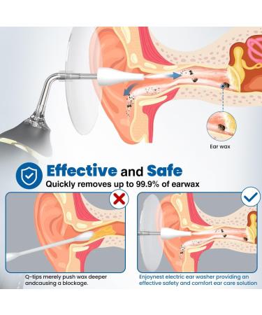EnjoyNest Electric Ear Wax Removal Kit - Ear Cleaning Tool with 4 Pressure Modes for Adults & Kids - Home Use DIY Ear Irrigation Flushing System - Black - Buy Online on GoSupps.com
