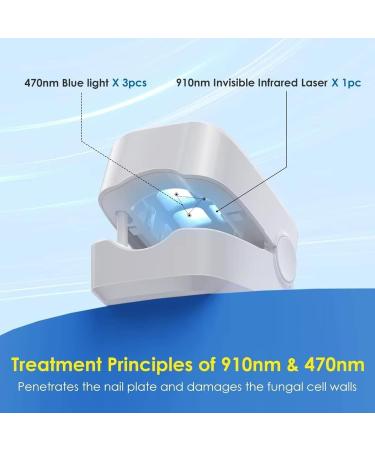 Nail Fungus Cleaning Laser Device Anti Fungal Laser Nail Fungus Laser Treatment for Damaged Discolored Thick Toenails & Fingernails Nail Therapy for Onychomycosis Easy to Use at Home - Buy Online on GoSupps.com
