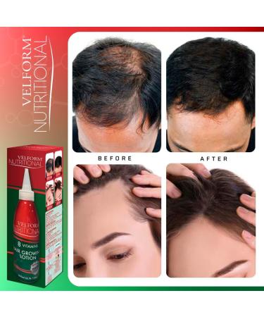 Velform Nutritional 200 ml Nourishing Vitalizing Hair Lotion - Buy Online on GoSupps.com