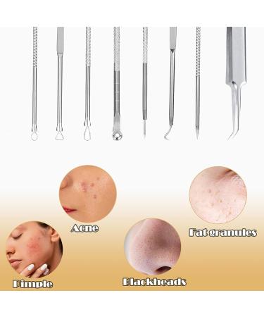 Stainless Steel Blackhead Remover Tool Kit - 5PCS Set for Face, Comedone Extraction Tools - Buy Online on GoSupps.com