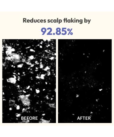 BEIGIC Volumizing Shampooing Scrub - Vegan Scalp Exfoliator & Clarifying Shampoo with Sacha Inchi Oil & Sea Salt for Itchy Scalp | Korean Haircare (8.81 Oz - Buy Online on GoSupps.com