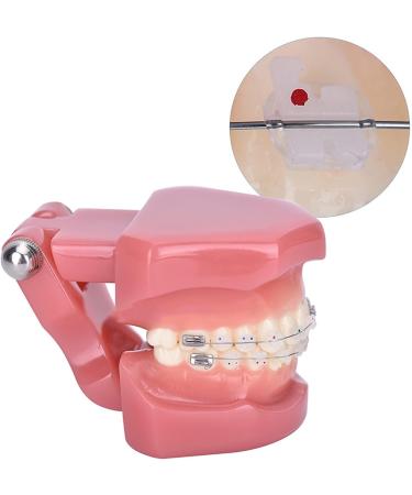 Dytah 1:1 Orthodontic Treatment Teeth Model - Patient Communication & Teaching Tool with Metal & Ceramic Brackets for Adults - Buy Online on GoSupps.com