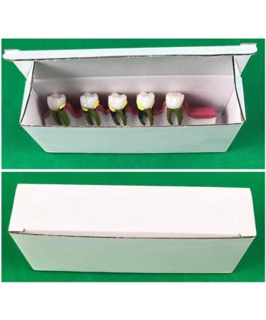 Dytah Dental Model - Adult Teeth Lessons for Periodontitis & Dental Disease Classification | Ideal for Teaching & Study - Buy Online on GoSupps.com