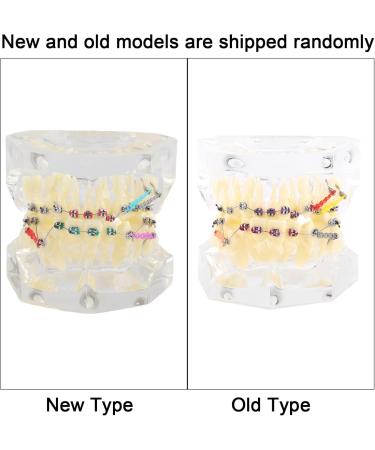 Fydun Dental Orthodontic Tooth Model for Malocclusion Treatment | International Shipping Available - Buy Online on GoSupps.com