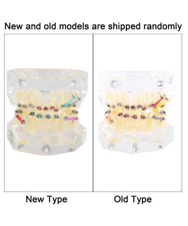 Tooth Model for Orthodontic Treatment - Wire Chain & Brackets | Dental Study Model for Precise Diagnosis & Planning - Buy Online on GoSupps.com