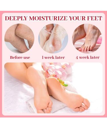9-Piece Nourishing Foot Mask Niacinamide Foot Mask Callus Cream Foot Socks Moisturising Cream Dry and Cracked Foot Care Callus Removal (Peach + Cherry + Strawberry) - Buy Online on GoSupps.com