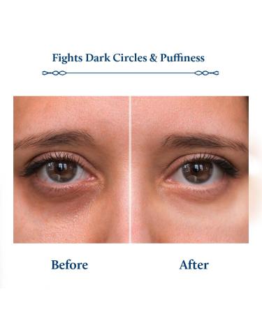 Blue Nectar Under Eye Serum - Plant-Based Niacinamide for Dark Circles & Puffiness | Advanced Skin Firming & Brightening Formula (17 Herbs 1 Fl OZ - Buy Online on GoSupps.com