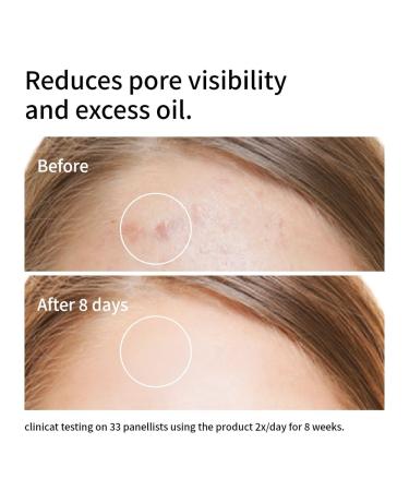 Niacinamide 10% + Zinc 1% Face Serum| Advanced Skin Tone & Oil Control| Hydrating & Anti-Blemish Formula| Lightweight & Fast-Absorbing 30ml - Buy Online on GoSupps.com