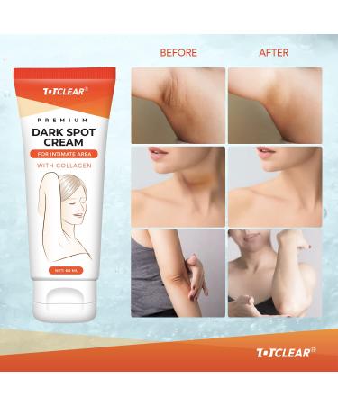 TOTCLEAR Dark Spot Remover Cream 100% Natural 60ML - For Face, Armpit, Neck, Back, Legs, Elbows & Private Areas - Buy Online on GoSupps.com