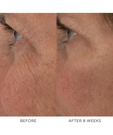 Noble Panacea The Rejuvenation Night Balm 30 Doses Refill Luxury Skincare Anti Aging Night Cream with Retinol Glycolic Acid Peptides & Lactic Acid - Buy Online on GoSupps.com