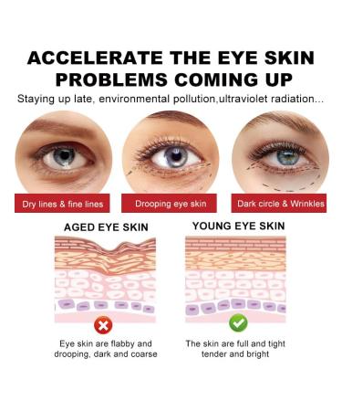 Premium Anti-Aging Eye Cream for Dark Circles Puffiness & Wrinkles - Hydrating Under Eye Treatment for Sensitive Skin - 1.7 OZ - Buy Online on GoSupps.com