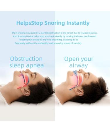 Anti Snoring Device - Customizable Mouth Guard for Men & Women | Comfortable & Effective Solution (S05) - Ships Internationally - Buy Online on GoSupps.com