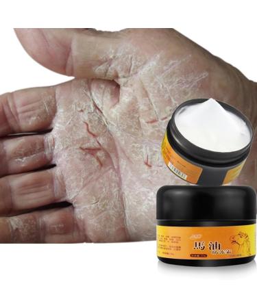 Allbesta Horse Oil Repair Hand Foot Care Exfoliating Cream Anti Frostbite Dry Cracks And Cracks Heal Ointment - Buy Online on GoSupps.com