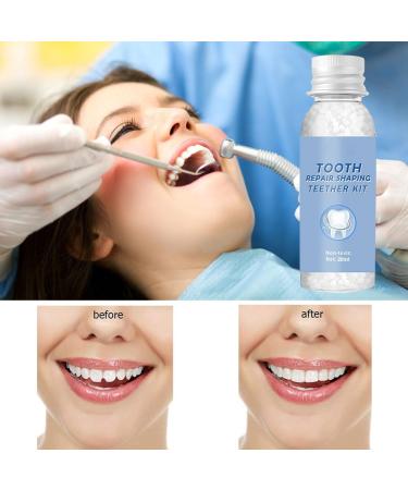 Premium Temporary Denture Set - DIY Heat Fit Beads for Quick Dental Restoration | Prosthesis & Repair Solutions - Buy Online on GoSupps.com