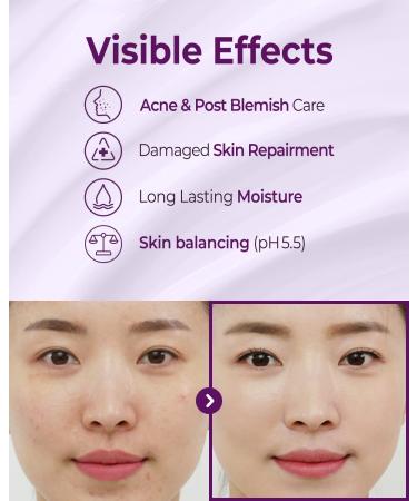 CRAZY SKIN Repair Trouble Care Sleeping Cream 1.76oz | Deep Moisturizing pH 5.5 Overnight Cream | Acne Prone Skin Moisturizer | Korean Night Mask Care - Buy Online on GoSupps.com