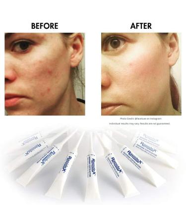 Buy Repechage Rapidex Marine Exfoliator - Natural Facial Scrub with Glycolic & AHA for Deep Cleansing & Anti-Aging - International Shipping Available - Buy Online on GoSupps.com
