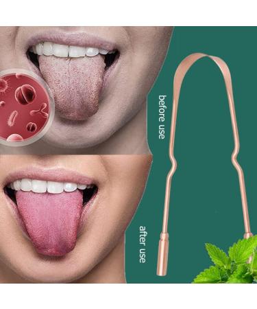 2 Sets Pure Copper Oral Care Scrapers Metal Cleaning Tools for Effective Oral Hygiene - Buy Online on GoSupps.com