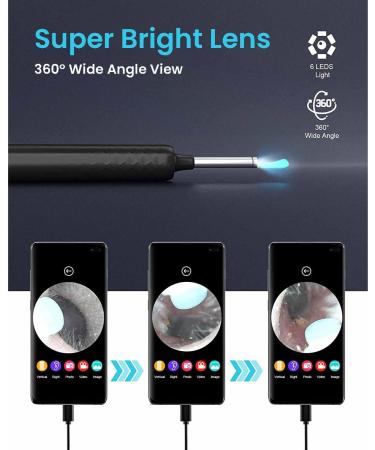 Smartbud 1920P Ear Wax Removal Tool with Camera - Otoscope Ear Cleaner Kit - 6 LED Lights for Ear Scope Endoscope - Ear Cleaning Camera - Buy Online on GoSupps.com