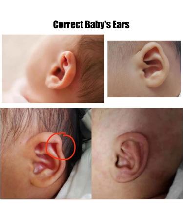 Silicone Infant Protruding Ear Patch Stickers - Baby Ear Corrector Tape (1 Roll/Box) - Buy Online on GoSupps.com