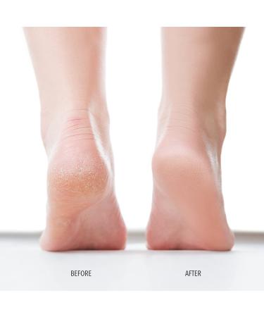 Londontown Pedicur Foot Balm Nourishing Foot Care for Soft Smooth Skin | International Shipping Available - Buy Online on GoSupps.com