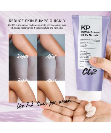 KP Bump Eraser Body Scrub: Exfoliating Keratosis Pilaris Strawberry Skin Treatment - Smooths Rough Bumpy Dry Skin on Arms Legs Buttocks - KP Scrub Wash Helps Reduce Ingrown Hair Bumps 8 Ounce (Pack of 1) - Buy Online on GoSupps.com