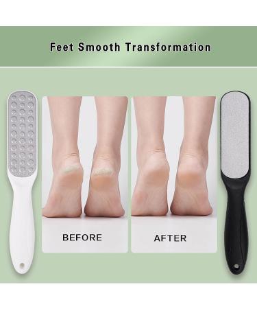 Feiccier Stainless Steel Double-Sided Foot Files - Professional Callus Remover for Cracked Heels, Corns, and Dead Skin - 2 Pcs Set - Buy Online on GoSupps.com
