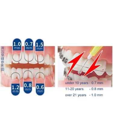 Chironal 20PCS/Set L Shape Brushing Your Teeth Wire Brush - 0.6mm-1.5mm - Buy Online on GoSupps.com