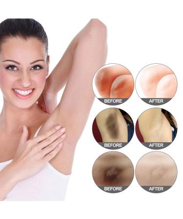 Crema para Aclarar las Axilas y Partes Intimas Eliminador de Manchas Oscuras para la Cara Crema Aclaradora para reas ntimas Cuello Axilas Codos Muslos Internos y Rodillas - Buy Online on GoSupps.com