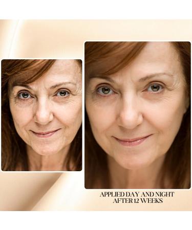 gymsegb Wrinkle Reduce Luminous Serum Snail Mucin Essence and Dynamic Hydrating Toner - Korean Anti-aging Bundle (Large) - Buy Online on GoSupps.com