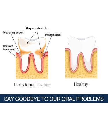 2pcs Teeth Whitening Powder - 50g Probiotics Tooth Powder for a Bright Smile Remove Stain Yellow Bad Breath Fresh - Tea Coffee Wine & Smoking Stain Remover - Buy Online on GoSupps.com